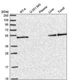 SLC25A46 Antibody in Western Blot (WB)