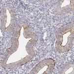 KRT84 Antibody in Immunohistochemistry (IHC)