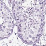 LGSN Antibody in Immunohistochemistry (IHC)