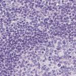 LGSN Antibody in Immunohistochemistry (IHC)