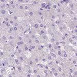 LGSN Antibody in Immunohistochemistry (IHC)