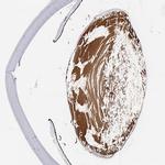 LGSN Antibody in Immunohistochemistry (IHC)