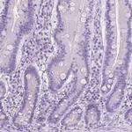 LGSN Antibody in Immunohistochemistry (IHC)