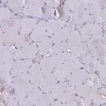 GLYAT Antibody in Immunohistochemistry (IHC)