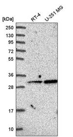 GLYAT Antibody in Western Blot (WB)