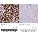 GLYAT Antibody