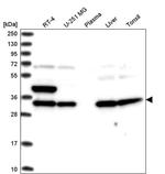 SPG21 Antibody in Western Blot (WB)