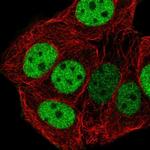 CHTF18 Antibody in Immunocytochemistry (ICC/IF)