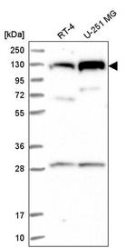 CHTF18 Antibody in Western Blot (WB)