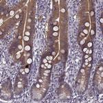 ACOT11 Antibody in Immunohistochemistry (IHC)