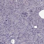 ACOT11 Antibody in Immunohistochemistry (IHC)