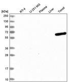 UTP3 Antibody in Western Blot (WB)