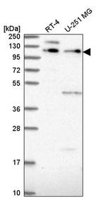 PEPP2 Antibody in Western Blot (WB)