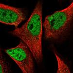 SPIDR Antibody in Immunocytochemistry (ICC/IF)