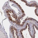 DNAJA4 Antibody in Immunohistochemistry (Paraffin) (IHC (P))