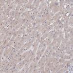 DNAJA4 Antibody in Immunohistochemistry (Paraffin) (IHC (P))