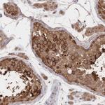 DNAJA4 Antibody in Immunohistochemistry (Paraffin) (IHC (P))