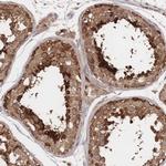 DNAJA4 Antibody in Immunohistochemistry (IHC)