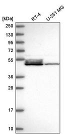 DNAJA4 Antibody in Western Blot (WB)