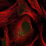 TRIP10 Antibody in Immunocytochemistry (ICC/IF)