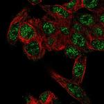 RHBG Antibody in Immunocytochemistry (ICC/IF)