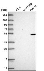 PDSS1 Antibody in Western Blot (WB)