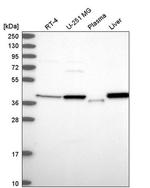 PSAT1 Antibody in Western Blot (WB)