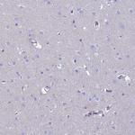 GNGT2 Antibody in Immunohistochemistry (Paraffin) (IHC (P))