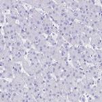 GNGT2 Antibody in Immunohistochemistry (Paraffin) (IHC (P))