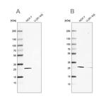 FAHD1 Antibody in Western Blot (WB)