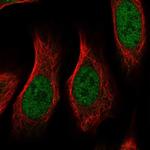 RGMA Antibody in Immunocytochemistry (ICC/IF)