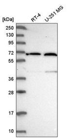 UTP15 Antibody in Western Blot (WB)