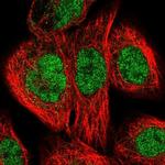 XPB Antibody in Immunocytochemistry (ICC/IF)