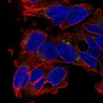 SLC29A3 Antibody in Immunocytochemistry (ICC/IF)