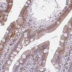 GLRX Antibody in Immunohistochemistry (Paraffin) (IHC (P))