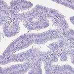 GLRX Antibody in Immunohistochemistry (Paraffin) (IHC (P))