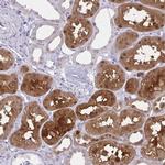 GLRX Antibody in Immunohistochemistry (IHC)