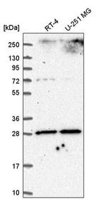 SLC25A5 Antibody in Western Blot (WB)