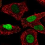 TALDO1 Antibody in Immunocytochemistry (ICC/IF)