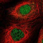 MTMR15 Antibody in Immunocytochemistry (ICC/IF)