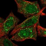 CLPX Antibody in Immunocytochemistry (ICC/IF)