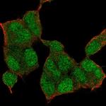 NSD1 Antibody in Immunocytochemistry (ICC/IF)