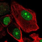 RBBP5 Antibody in Immunocytochemistry (ICC/IF)