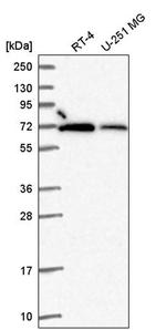 RBBP5 Antibody in Western Blot (WB)