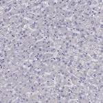 CITED1 Antibody in Immunohistochemistry (Paraffin) (IHC (P))