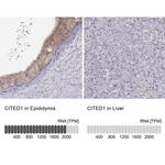 CITED1 Antibody in Immunohistochemistry (IHC)