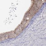 CITED1 Antibody in Immunohistochemistry (IHC)