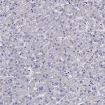 CITED1 Antibody in Immunohistochemistry (IHC)