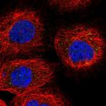 RDH10 Antibody in Immunocytochemistry (ICC/IF)