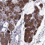 Tomosyn Antibody in Immunohistochemistry (IHC)